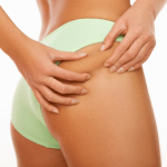 revitol-cellulite-solution